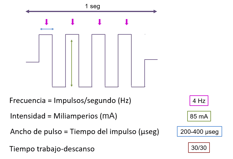 Electroestimulación muscular, parámetros: la Frecuencia (Hz) -  ®